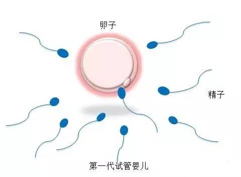 针灸